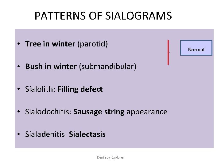 PATTERNS OF SIALOGRAMS • Tree in winter (parotid) • Bush in winter (submandibular) •