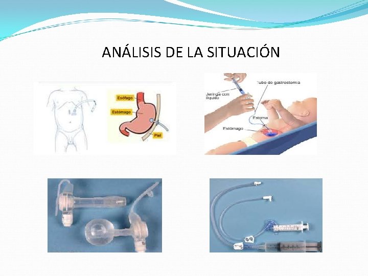 ANÁLISIS DE LA SITUACIÓN 