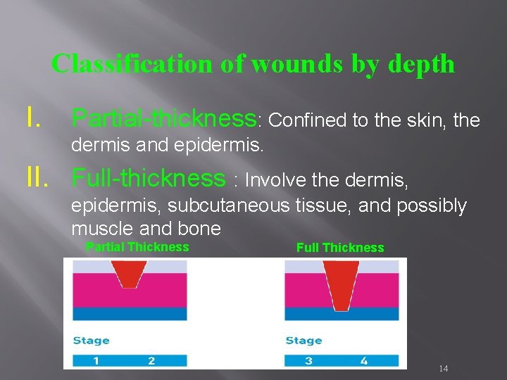 Classification of wounds by depth I. Partial-thickness: Confined to the skin, the dermis and Classification of wounds by depth I. Partial-thickness: Confined to the skin, the dermis and
