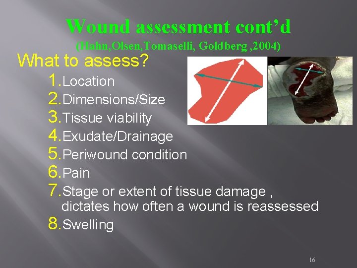 Wound assessment cont’d (Hahn, Olsen, Tomaselli, Goldberg , 2004) What to assess? 1. Location Wound assessment cont’d (Hahn, Olsen, Tomaselli, Goldberg , 2004) What to assess? 1. Location