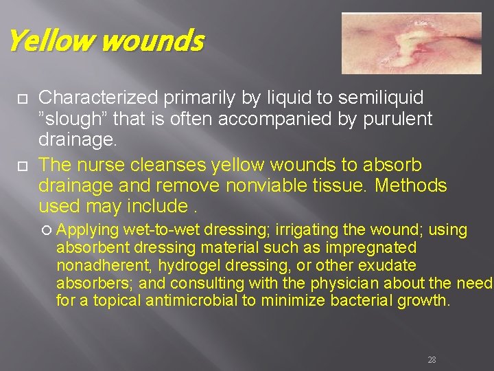Yellow wounds Characterized primarily by liquid to semiliquid ”slough” that is often accompanied by Yellow wounds Characterized primarily by liquid to semiliquid ”slough” that is often accompanied by