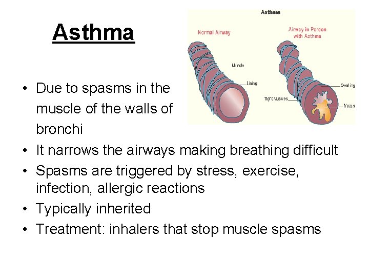 Asthma • Due to spasms in the muscle of the walls of bronchi •