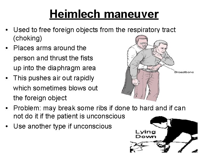 Heimlech maneuver • Used to free foreign objects from the respiratory tract (choking) •