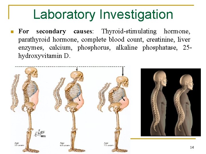 Laboratory Investigation n For secondary causes: Thyroid-stimulating hormone, parathyroid hormone, complete blood count, creatinine,