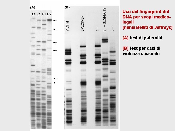 Uso del fingerprint del DNA per scopi medicolegali (minisatelliti di Jeffreys) (A) test di Uso del fingerprint del DNA per scopi medicolegali (minisatelliti di Jeffreys) (A) test di