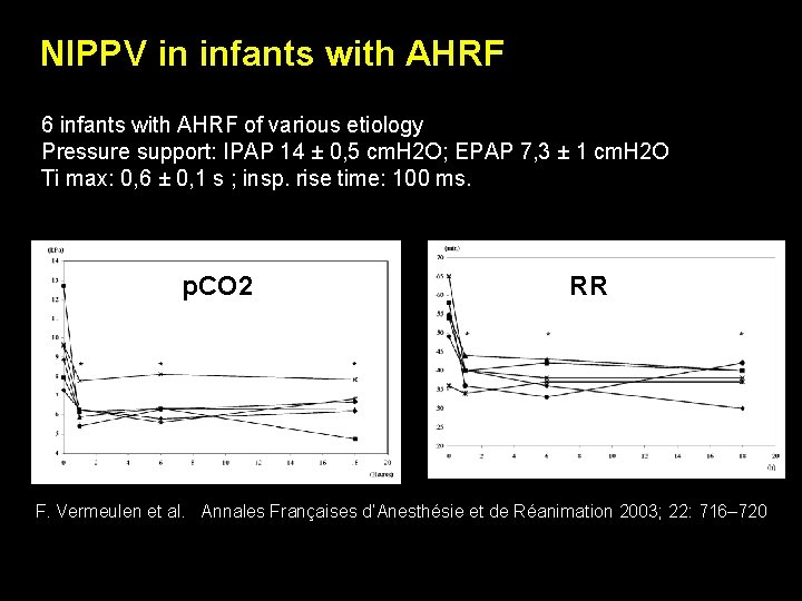 NIPPV in infants with AHRF 6 infants with AHRF of various etiology Pressure support: