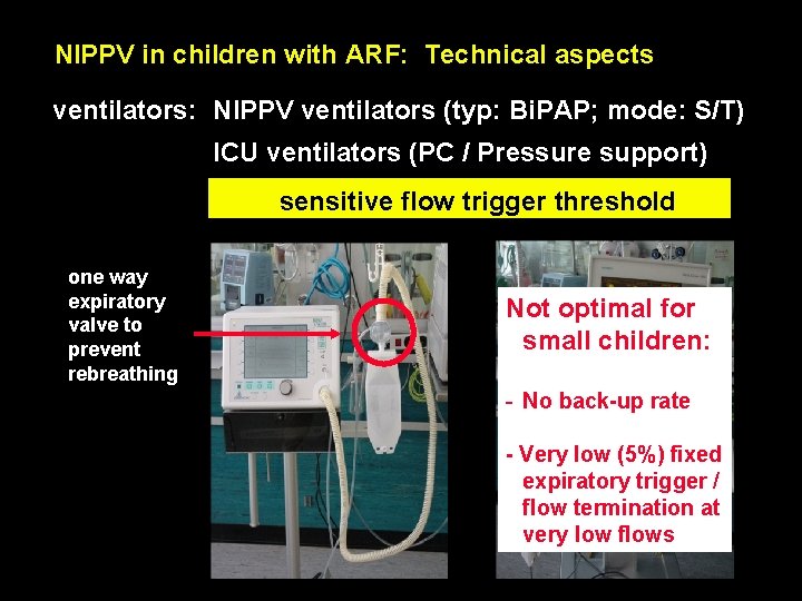  NIPPV in children with ARF: Technical aspects ventilators: NIPPV ventilators (typ: Bi. PAP;