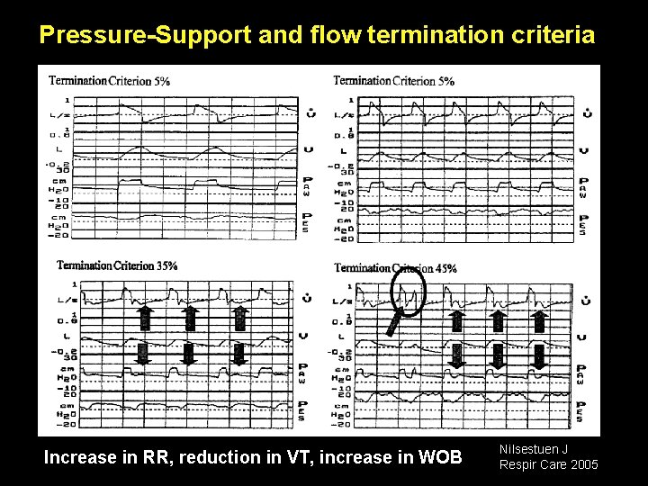 Pressure-Support and flow termination criteria Increase in RR, reduction in VT, increase in WOB Pressure-Support and flow termination criteria Increase in RR, reduction in VT, increase in WOB