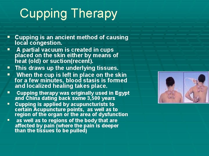 Cupping Therapy § Cupping is an ancient method of causing § § § local