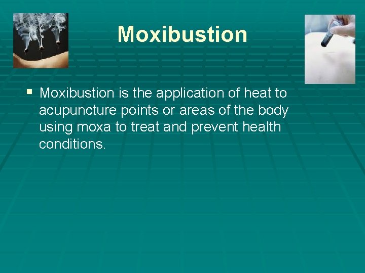 Moxibustion § Moxibustion is the application of heat to acupuncture points or areas of