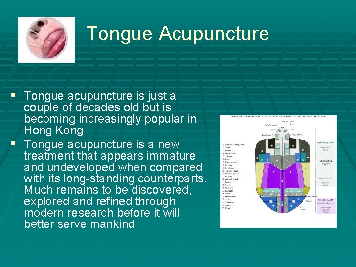 Tongue Acupuncture § Tongue acupuncture is just a couple of decades old but is