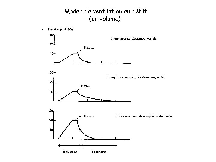 Modes de ventilation en débit (en volume) 