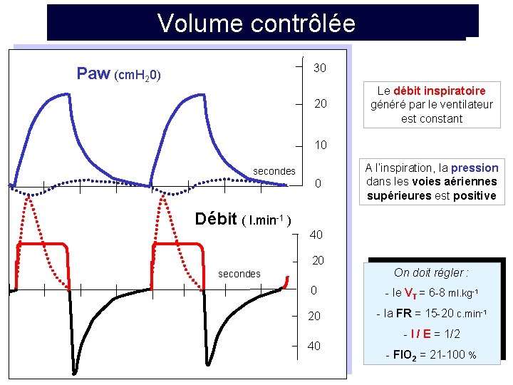 Ventilation spontanée calme de repos Volume contrôlée 30 Paw (cm. H 20) 20 Le