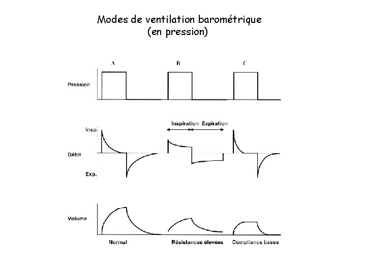 Modes de ventilation barométrique (en pression) 