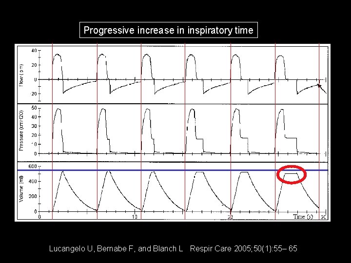 Progressive increase in inspiratory time Lucangelo U, Bernabe F, and Blanch L Respir Care