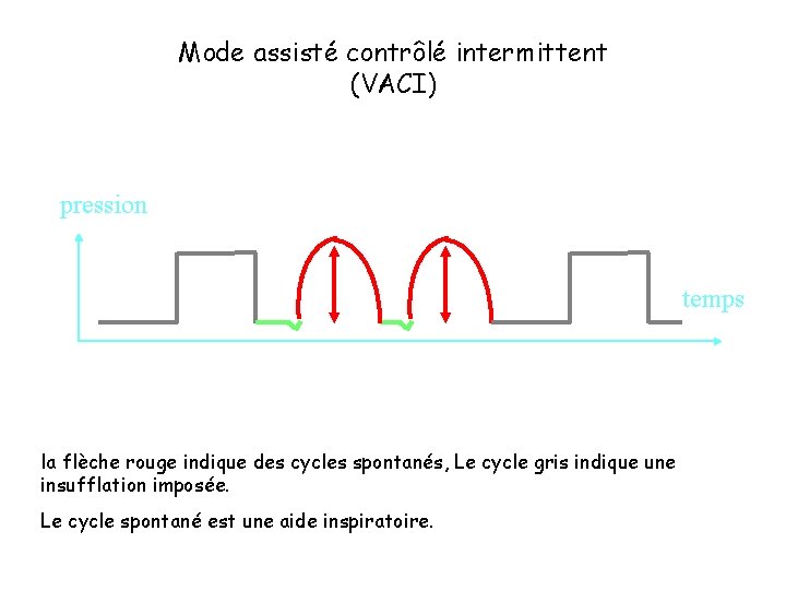 Mode assisté contrôlé intermittent (VACI) pression temps la flèche rouge indique des cycles spontanés,