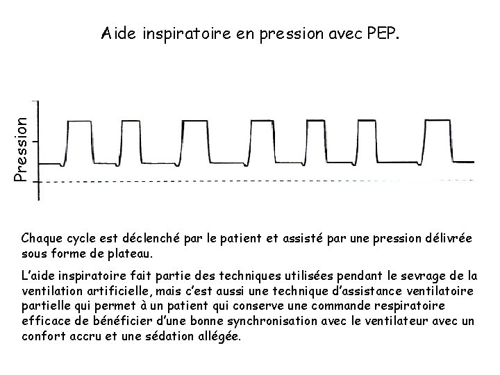 Pression Aide inspiratoire en pression avec PEP. Chaque cycle est déclenché par le patient