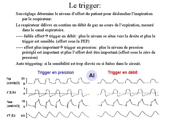 Le trigger: Son réglage détermine le niveau d’effort du patient pour déclencher l’inspiration par