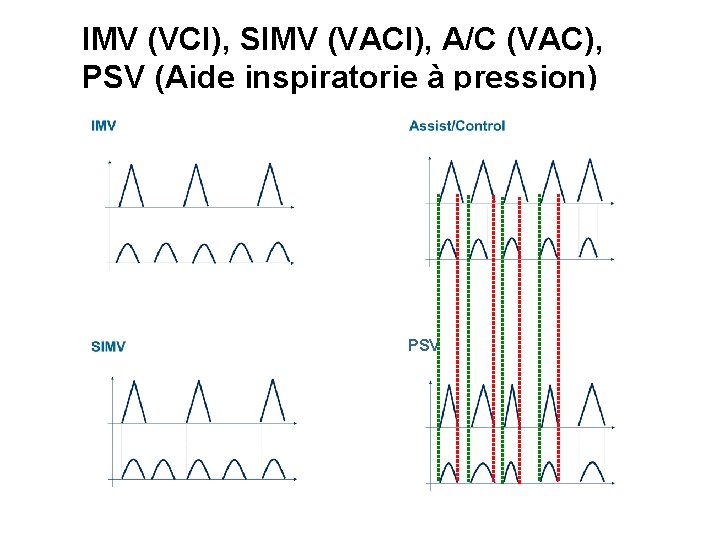 IMV (VCI), SIMV (VACI), A/C (VAC), PSV (Aide inspiratorie à pression) PSV 