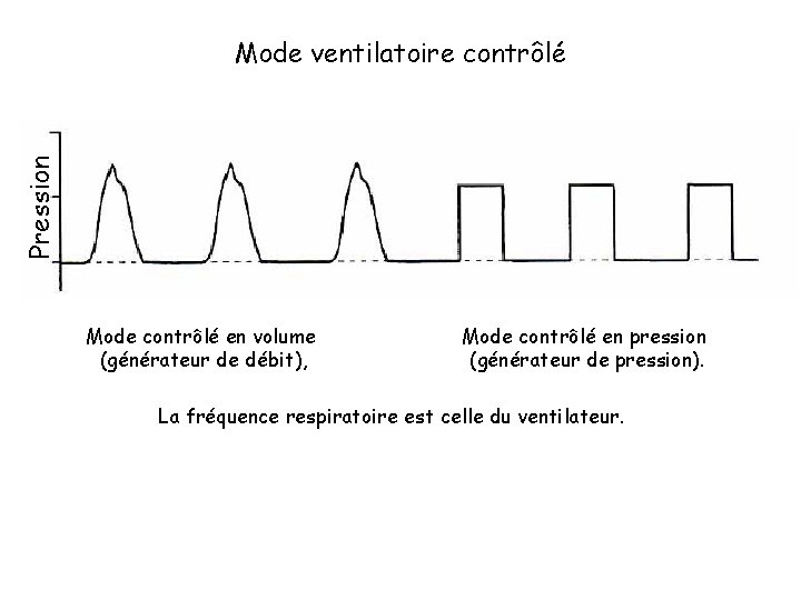 Pression Mode ventilatoire contrôlé Mode contrôlé en volume (générateur de débit), Mode contrôlé en