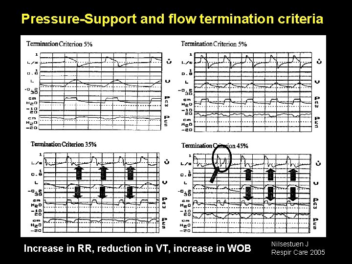 Pressure-Support and flow termination criteria Increase in RR, reduction in VT, increase in WOB