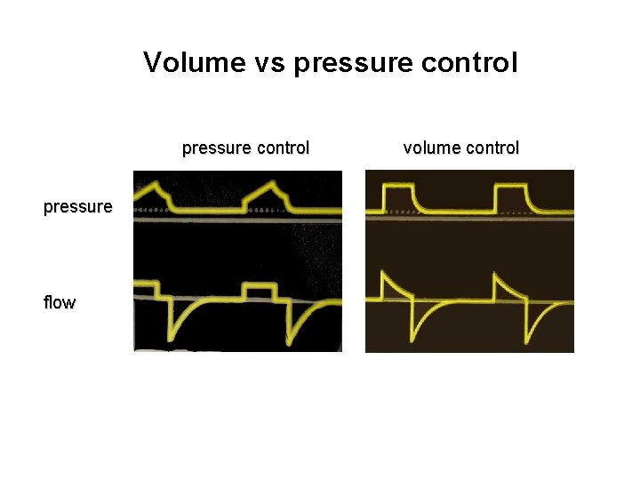 Volume vs pressure control pressure flow volume control 