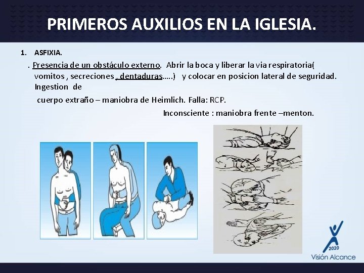 PRIMEROS AUXILIOS EN LA IGLESIA. 1. ASFIXIA. . Presencia de un obstáculo externo. Abrir