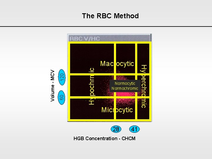 The RBC Method Hypochrmic 120 60 Volume - MCV Normocytic Normochromic Microcytic 28 41