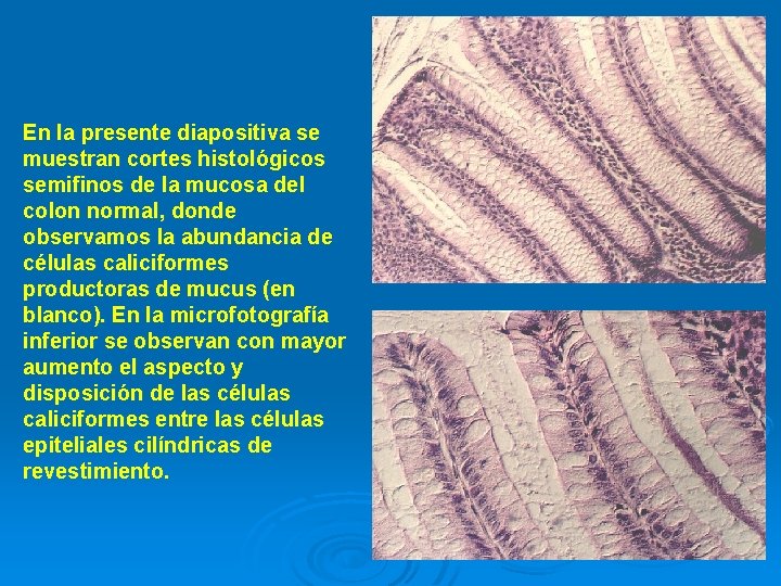 En la presente diapositiva se muestran cortes histológicos semifinos de la mucosa del colon