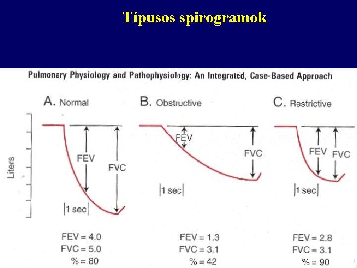 Típusos spirogramok 