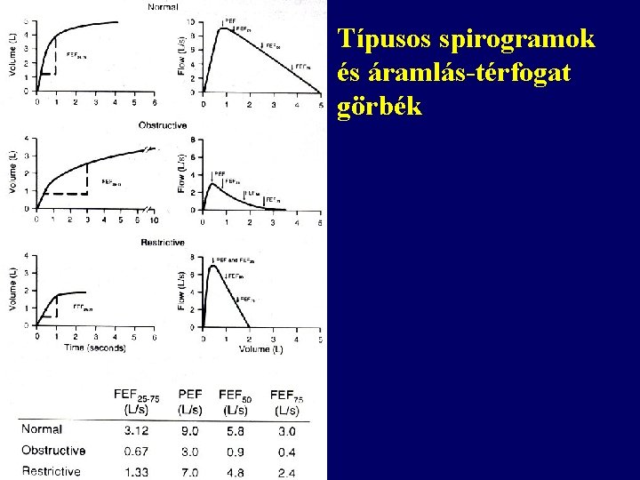 Típusos spirogramok és áramlás-térfogat görbék 