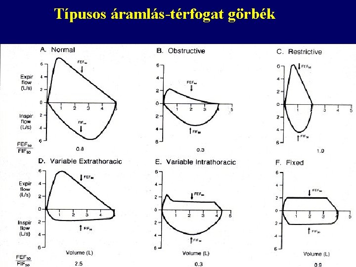 Típusos áramlás-térfogat görbék 