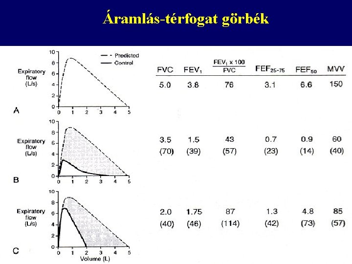 Áramlás-térfogat görbék 