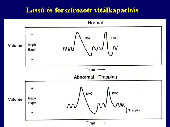 Lassú és forszírozott vitálkapacitás 