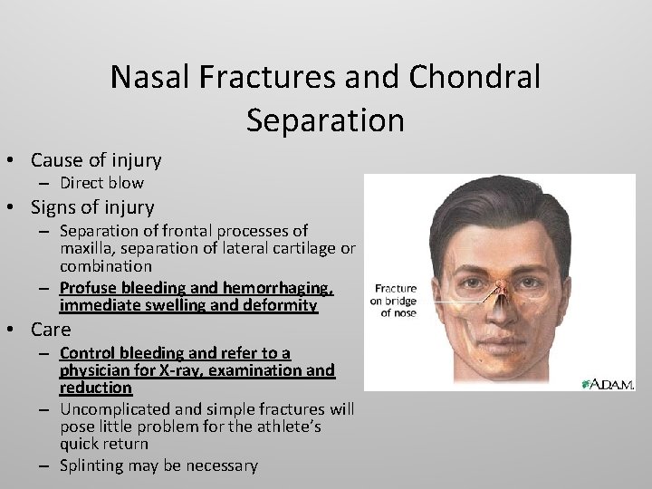 Nasal Fractures and Chondral Separation • Cause of injury – Direct blow • Signs
