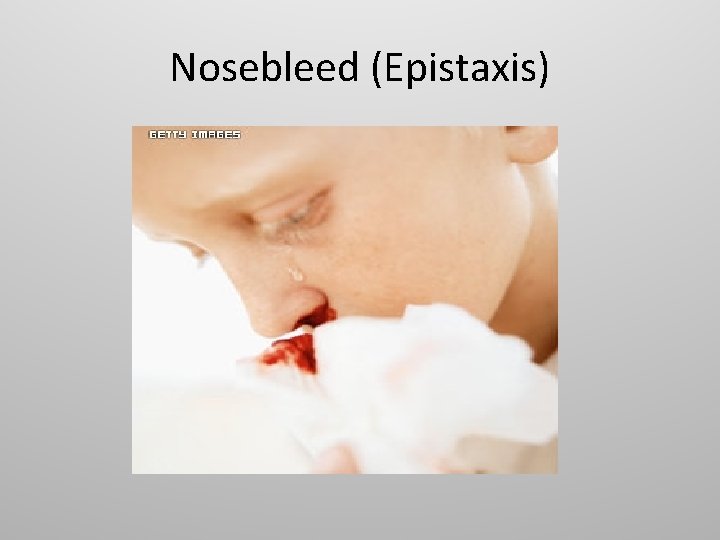 Nosebleed (Epistaxis) 