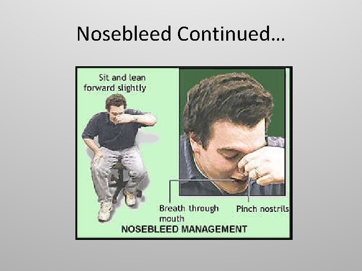 Nosebleed Continued… 
