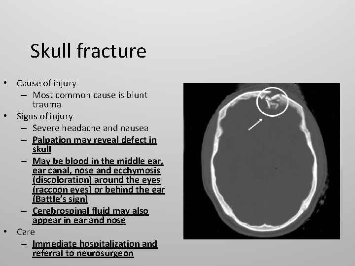 Skull fracture • Cause of injury – Most common cause is blunt trauma •