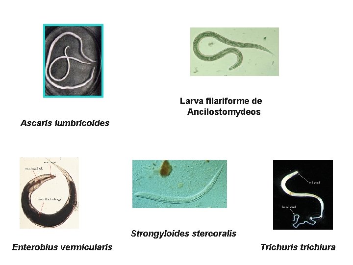 Larva filariforme de Ancilostomydeos Ascaris lumbricoides Strongyloides stercoralis Enterobius vermicularis Trichuris trichiura 