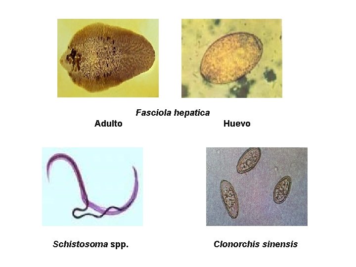 Fasciola hepatica Adulto Schistosoma spp. Huevo Clonorchis sinensis 