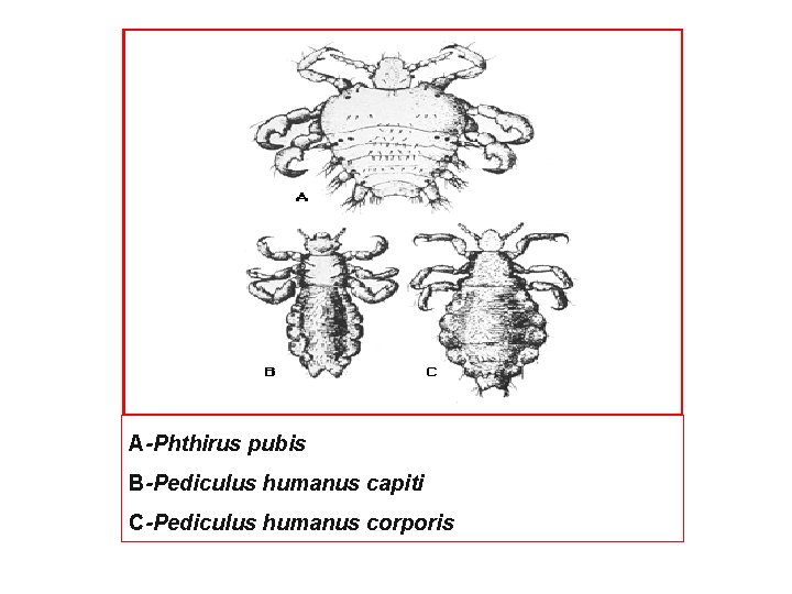 A-Phthirus pubis B-Pediculus humanus capiti C-Pediculus humanus corporis 