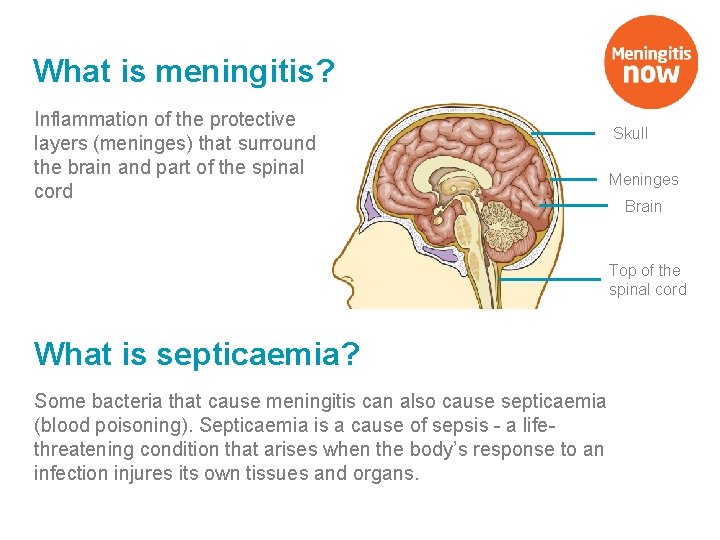 What is meningitis? Inflammation of the protective layers (meninges) that surround the brain and