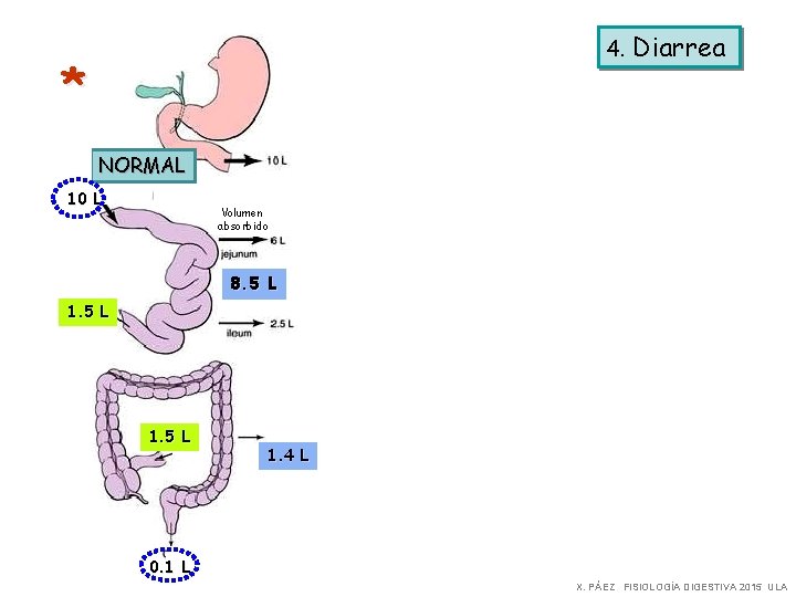 4. Diarrea * NORMAL 10 L Disfunción INTESTINO Disfunción COLON Volumen absorbido 8. 5