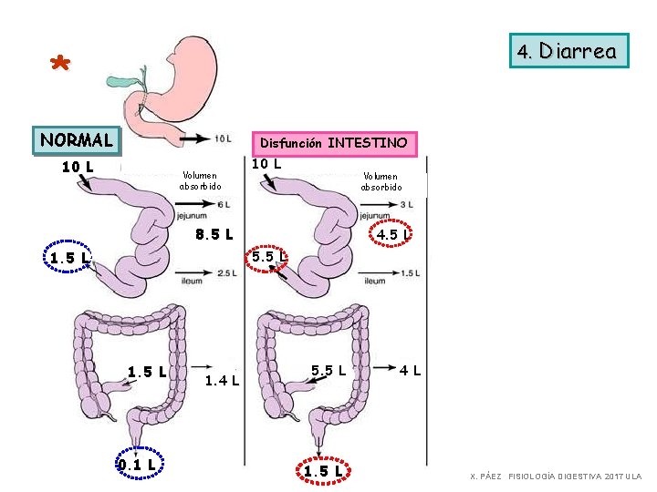 4. Diarrea * NORMAL Disfunción INTESTINO 10 L Volumen absorbido 8. 5 L 1.