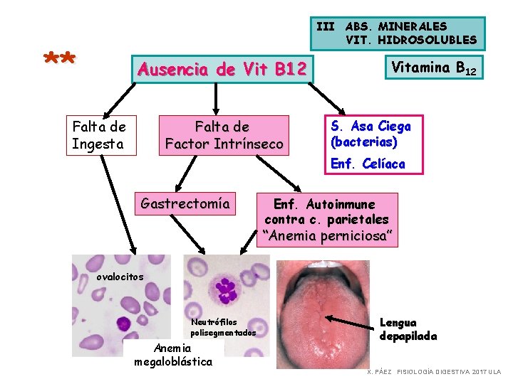 III ABS. MINERALES VIT. HIDROSOLUBLES ** Ausencia de Vit B 12 Falta de Ingesta