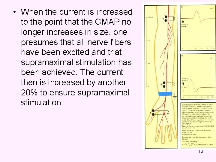  • When the current is increased to the point that the CMAP no