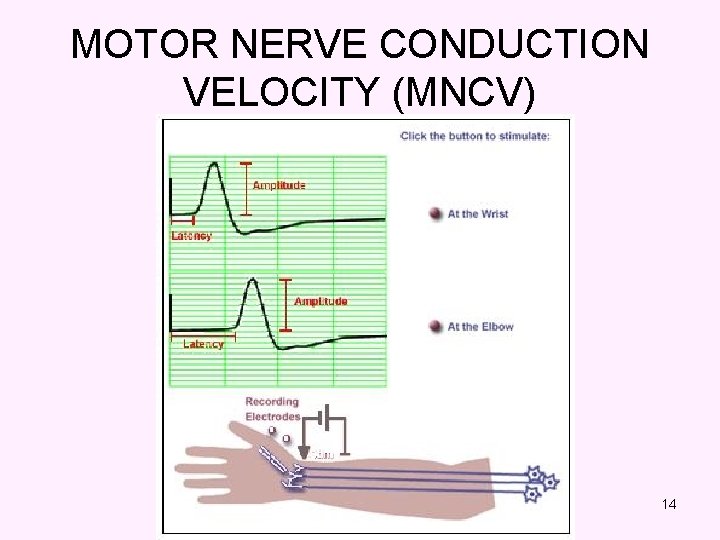 MOTOR NERVE CONDUCTION VELOCITY (MNCV) 14 