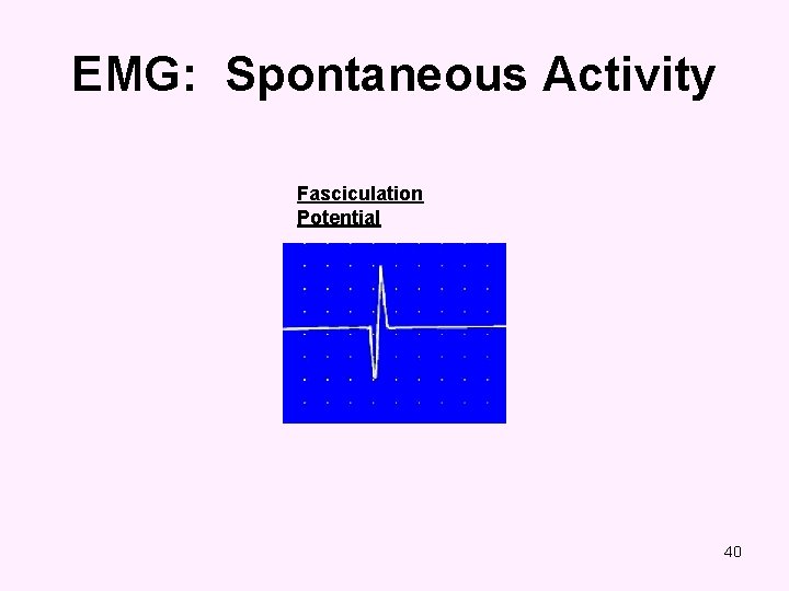 EMG: Spontaneous Activity Fasciculation Potential 40 