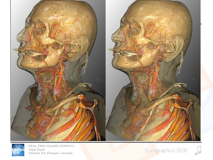 Pre-Integrated Classification REAL-TIME VOLUME GRAPHICS Klaus Engel Siemens AG, Erlangen, Germany Eurographics 2006 