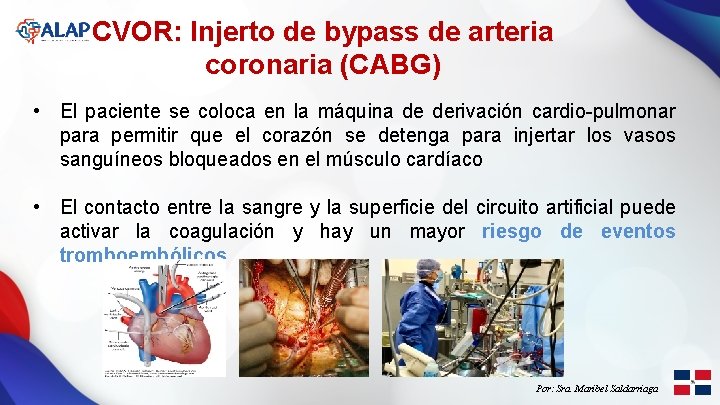 CVOR: Injerto de bypass de arteria coronaria (CABG) • El paciente se coloca en